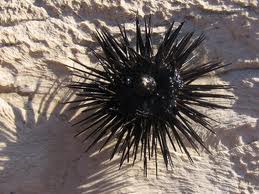 Aruba Essential Health Supplies shares some helpful information and useful tips on handling sea urchins and their stings